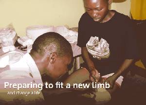 Fitting a New Limb